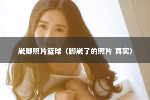 崴脚照片篮球（脚崴了的照片 真实）